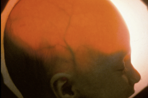 Inside the stealthy startup that pitched brainless human clones